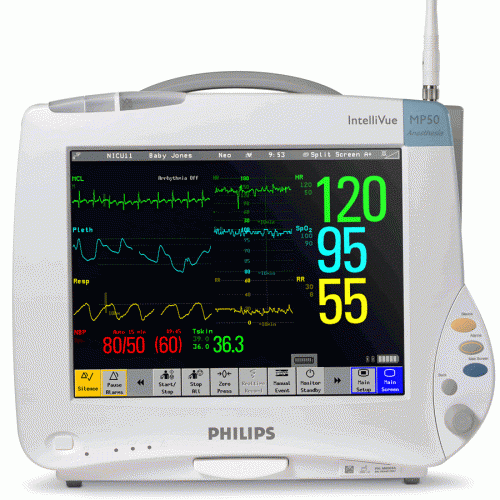 Монитор пациента прикроватный