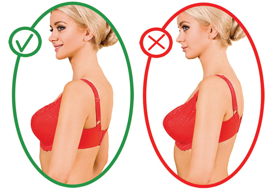 Фото до и после увеличения груди через подмышку