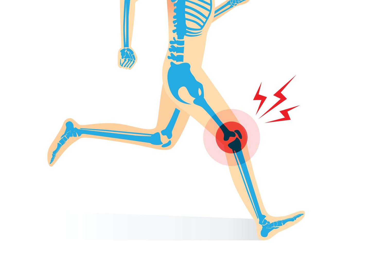 Что происходит при травме колена?